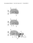 DENTAL IMPLANTS, TOOLS, AND METHODS diagram and image