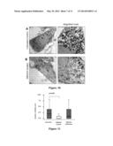 SMALL MOLECULE THERAPEUTIC COMPOUNDS TARGETING THIOESTERASE DEFICIENCY     DISORDERS AND METHODS OF USING THE SAME diagram and image