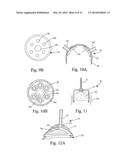 Organ Manipulator Apparatus diagram and image