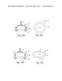 Organ Manipulator Apparatus diagram and image