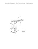 SURGICAL ACCESS SYSTEM AND RELATED METHODS diagram and image