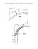 VAGINAL SPECULUM APPARATUS diagram and image