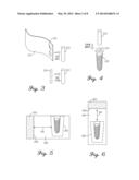 Orthopedic Screw For Measuring A Parameter Of The Muscular-Skeletal System diagram and image