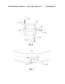 MICROBUBBLE MEDICAL DEVICES diagram and image