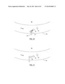 MICROBUBBLE MEDICAL DEVICES diagram and image