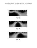 DEVICES FOR DETERMINING THE RELATIVE SPATIAL CHANGE IN SUBSURFACE     RESISTIVITIES ACROSS FREQUENCIES IN TISSUE diagram and image