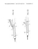 PERIPHERAL ARTERIALIZATION DEVICES AND METHODS OF USING THE SAME diagram and image