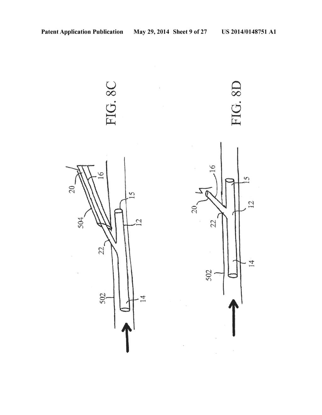 PERIPHERAL ARTERIALIZATION DEVICES AND METHODS OF USING THE SAME - diagram, schematic, and image 10