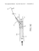 PERIPHERAL ARTERIALIZATION DEVICES AND METHODS OF USING THE SAME diagram and image