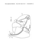 PERIPHERAL ARTERIALIZATION DEVICES AND METHODS OF USING THE SAME diagram and image