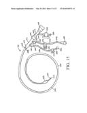 PERIPHERAL ARTERIALIZATION DEVICES AND METHODS OF USING THE SAME diagram and image