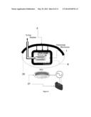 METHOD AND DEVICE TO TREAT KIDNEY DISEASE diagram and image