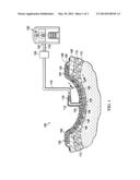 RE-EPITHELIALIZATION WOUND DRESSINGS AND SYSTEMS diagram and image