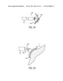 SURGICAL INSTRUMENTS AND END EFFECTORS THEREFOR diagram and image