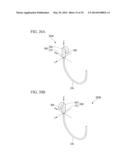 TISSUE LIGATING DEVICE diagram and image