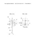 TISSUE LIGATING DEVICE diagram and image