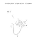 TISSUE LIGATING DEVICE diagram and image