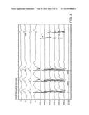 Automated Assessment of Atrioventricular and Ventriculoatrial Conduction diagram and image