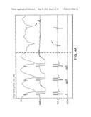 Automated Assessment of Atrioventricular and Ventriculoatrial Conduction diagram and image