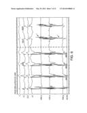 Automated Assessment of Atrioventricular and Ventriculoatrial Conduction diagram and image