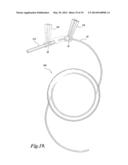 DEVICE AND METHOD FOR INTRAOCULAR DRUG DELIVERY diagram and image