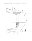 Surgical Guides from Scanned Implant Data diagram and image