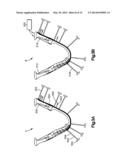 Surgical Guides from Scanned Implant Data diagram and image