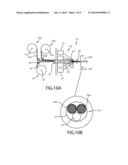 STRIP LINED CATHETERS AND METHODS FOR CONSTRUCTING AND PROCESSING STRIP     LINED CATHETERS diagram and image