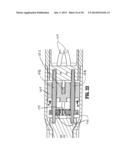 Flexible Endoluminal Surgical Instrument diagram and image