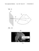 MEDICAL SYSTEM, MEDICAL IMAGING APPARATUS, AND METHOD OF PROVIDING     THREE-DIMENSIONAL MARKER diagram and image