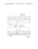 Patient Monitor for Generating Real-Time Relational Animations of Human     Organs in Response to Physiologic Signals diagram and image