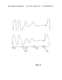 Patient Monitor for Generating Real-Time Relational Animations of Human     Organs in Response to Physiologic Signals diagram and image