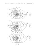 TURBOCHARGER diagram and image