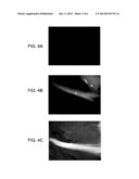 METHODS OF DETECTING MYELIN BASIC PROTEIN diagram and image