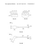 DEVICES AND METHODS FOR TREATING PAIN ASSOCIATED WITH TONSILLECTOMIES diagram and image