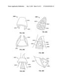 DEVICES AND METHODS FOR TREATING PAIN ASSOCIATED WITH TONSILLECTOMIES diagram and image