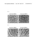 PHARMACEUTICAL COMPOSITION FOR THE TREATMENT AND PREVENTION OF CARDIAC     DISEASE diagram and image