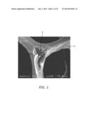 FOAM-LIKE MATERIALS AND METHODS FOR PRODUCING SAME diagram and image