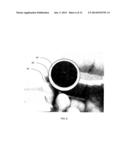 BIOREACTOR USING ACOUSTIC STANDING WAVES diagram and image