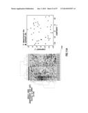 EMT SIGNATURES AND PREDICTIVE MARKERS AND METHOD OF USING THE SAME diagram and image