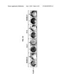 PLA2R1 AS ANTI-TUMORAL COMPOUND AND AS BIOMARKER FOR THE DETECTION OF     CANCER diagram and image