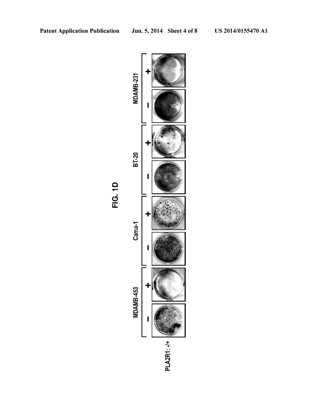 PLA2R1 AS ANTI-TUMORAL COMPOUND AND AS BIOMARKER FOR THE DETECTION OF     CANCER - diagram, schematic, and image 05