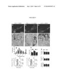 TREATING NEUROLOGICAL DISEASE OR INJURY WITH A DYNAMIN-RELATED PROTEIN 1     (DRP1) ENCODING NUCLEIC ACID diagram and image