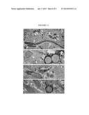 TREATING NEUROLOGICAL DISEASE OR INJURY WITH A DYNAMIN-RELATED PROTEIN 1     (DRP1) ENCODING NUCLEIC ACID diagram and image