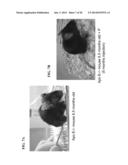 F11 RECEPTOR (F11R) ANTAGONISTS AS THERAPEUTIC AGENTS diagram and image