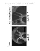 F11 RECEPTOR (F11R) ANTAGONISTS AS THERAPEUTIC AGENTS diagram and image