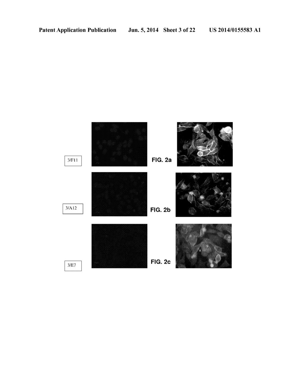 MONOCLONAL ANTIBODIES AND SINGLE CHAIN ANTIBODY FRAGMENTS AGAINST     CELL-SURFACE PROSTATE SPECIFIC MEMBRANE ANTIGEN - diagram, schematic, and image 04