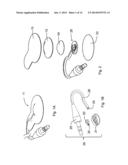 DISPOSABLE LIGHT SOURCE FOR ENHANCED VISUALIZATION OF SUBCUTANEOUS     STRUCTURES diagram and image