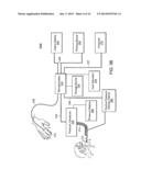 AUTOMATED PROCESS FOR ASSESSING CARDIAC FILLING PRESSURE NON-INVASIVELY diagram and image