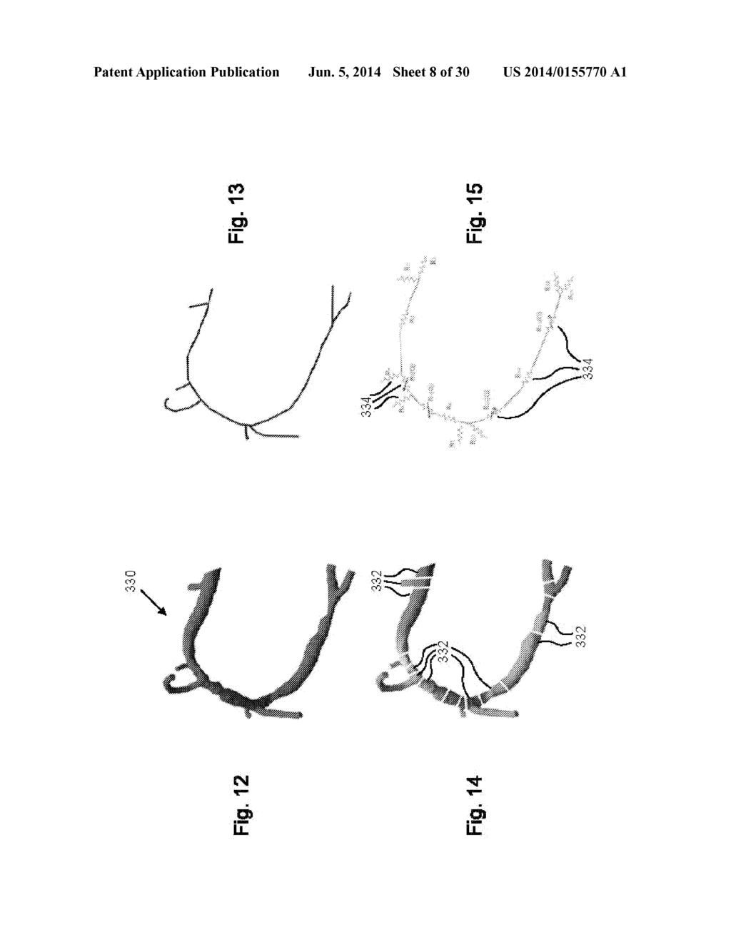 METHOD AND SYSTEM FOR PATIENT-SPECIFIC MODELING OF BLOOD FLOW - diagram, schematic, and image 09